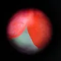 Cardiac